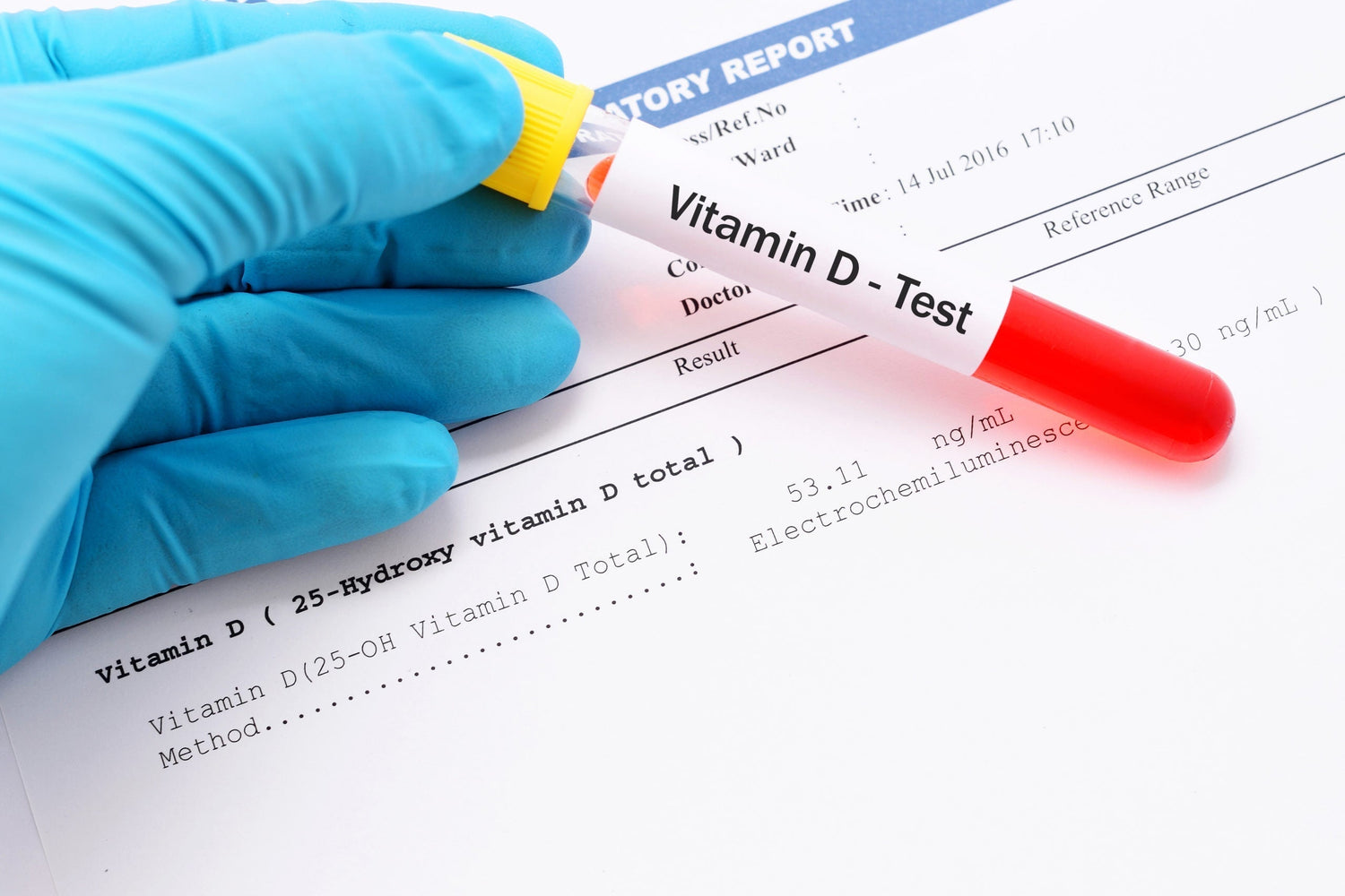 Mold’s Effect on Vitamin D Labs: What to Look For